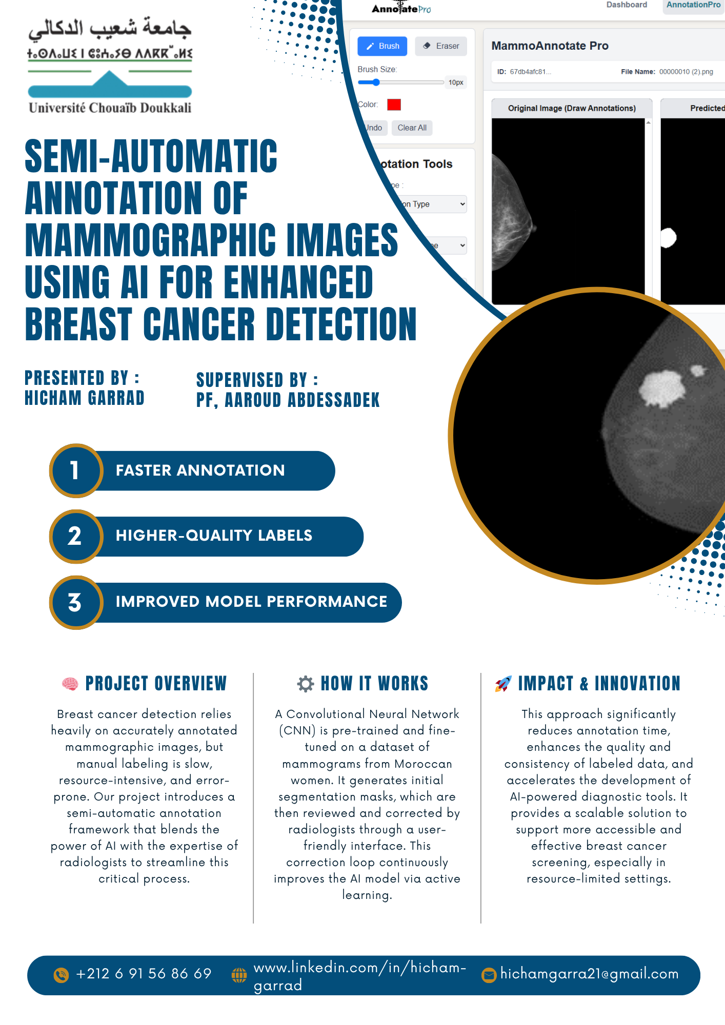 Semi-Automatic Annotation of Mammographic Images Using AI for Enhanced Breast Cancer Detection